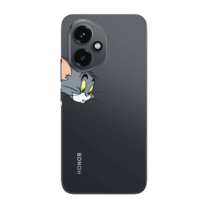 Honor Magic 400 Tom 1 Transparent Silicone TPU Θήκη